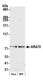 ARA70 Antibody in Western Blot (WB)