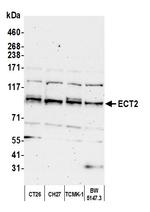 ECT2 Antibody in Western Blot (WB)