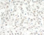 MED13L Antibody in Immunohistochemistry (Paraffin) (IHC (P))