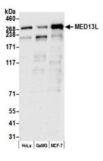 MED13L Antibody in Western Blot (WB)