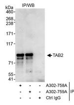 TAB2 Antibody in Immunoprecipitation (IP)