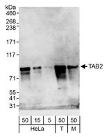 TAB2 Antibody in Western Blot (WB)