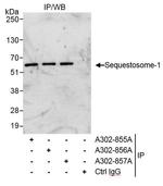 Sequestosome-1 Antibody in Immunoprecipitation (IP)