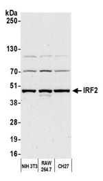 IRF2 Antibody in Western Blot (WB)