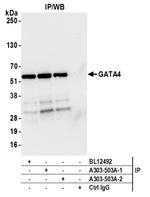 GATA4 Antibody in Immunoprecipitation (IP)