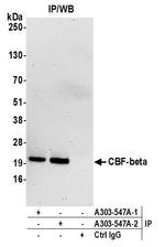 CBF-beta Antibody in Immunoprecipitation (IP)