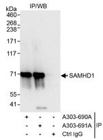 SAMHD1 Antibody in Immunoprecipitation (IP)