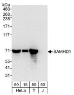 SAMHD1 Antibody in Western Blot (WB)