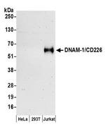 DNAM-1 Antibody in Western Blot (WB)