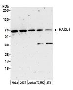 HACL1 Antibody in Western Blot (WB)