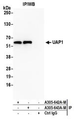 UAP1 Antibody in Immunoprecipitation (IP)