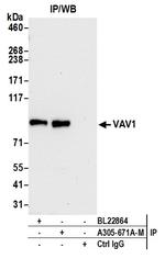 VAV1 Antibody in Immunoprecipitation (IP)