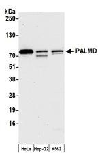 PALMD Antibody in Western Blot (WB)