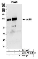 VASN Antibody in Immunoprecipitation (IP)