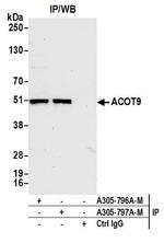 ACOT9 Antibody in Immunoprecipitation (IP)