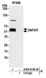 ZNF207 Antibody in Immunoprecipitation (IP)