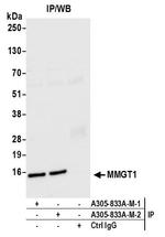 MMGT1 Antibody in Immunoprecipitation (IP)