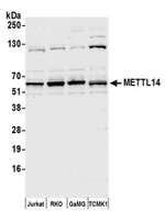 METTL14 Antibody in Western Blot (WB)