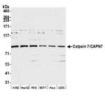 Calpain 7/CAPN7 Antibody in Western Blot (WB)