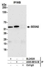 SESN2 Antibody in Immunoprecipitation (IP)