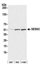SESN2 Antibody in Western Blot (WB)