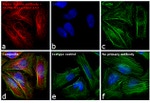 Mouse IgG (H+L) Highly Cross-Adsorbed Secondary Antibody in Immunocytochemistry (ICC/IF)