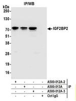 IGF2BP2 Antibody in Immunoprecipitation (IP)