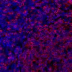 HLA-DR Antibody in Immunohistochemistry (Paraffin) (IHC (P))