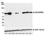HdmX/MDM4 Antibody in Western Blot (WB)