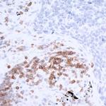 CD247/CD3Z Antibody in Immunohistochemistry (Paraffin) (IHC (P))