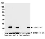 CD247/CD3Z Antibody in Western Blot (WB)