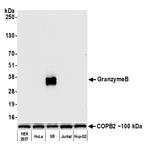 Granzyme B Antibody in Western Blot (WB)