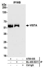 VISTA Antibody in Immunoprecipitation (IP)