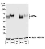 VISTA Antibody in Western Blot (WB)