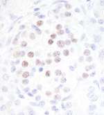 MafA Antibody in Immunohistochemistry (Paraffin) (IHC (P))