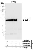 Bcl11a Antibody in Immunoprecipitation (IP)