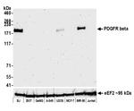 PDGFR beta Antibody in Western Blot (WB)