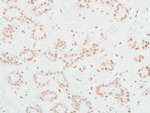 MED12 Antibody in Immunohistochemistry (Paraffin) (IHC (P))