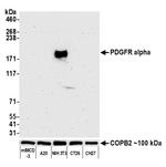 PDGFR alpha Antibody in Western Blot (WB)