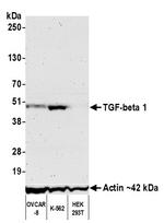 TGF-beta 1 Antibody in Western Blot (WB)