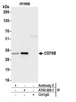 CD79B Antibody in Immunoprecipitation (IP)
