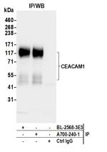 CEACAM1 Antibody in Immunoprecipitation (IP)