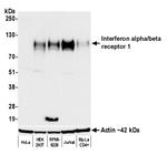 Interferon alpha/beta receptor 1 Antibody in Western Blot (WB)
