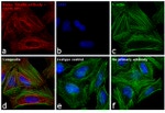 Mouse IgG (H+L) Cross-Adsorbed Secondary Antibody in Immunocytochemistry (ICC/IF)