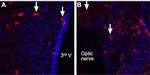 Angiotensin II Receptor Type-2 (extracellular) Antibody in Immunohistochemistry (IHC)