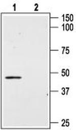 Angiotensin II Receptor Type-2 (extracellular) Antibody in Western Blot (WB)