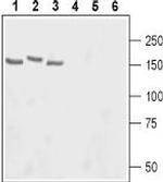 Adenylate Cyclase 3 (AC3) (extracellular) Antibody in Western Blot (WB)