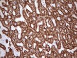 ABAT Antibody in Immunohistochemistry (Paraffin) (IHC (P))