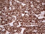 ABAT Antibody in Immunohistochemistry (Paraffin) (IHC (P))