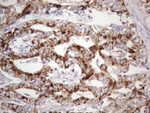 ABAT Antibody in Immunohistochemistry (Paraffin) (IHC (P))